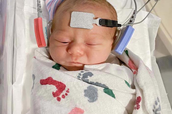 baby with hearing screening devices