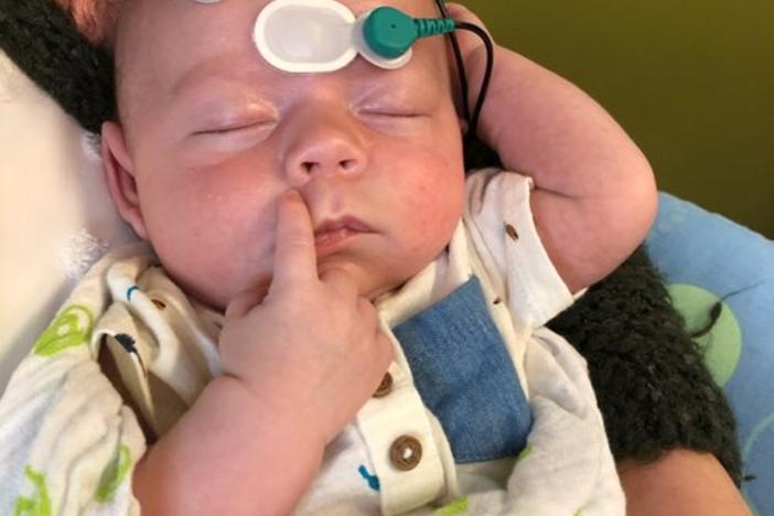 baby with hearing screening monitors attached